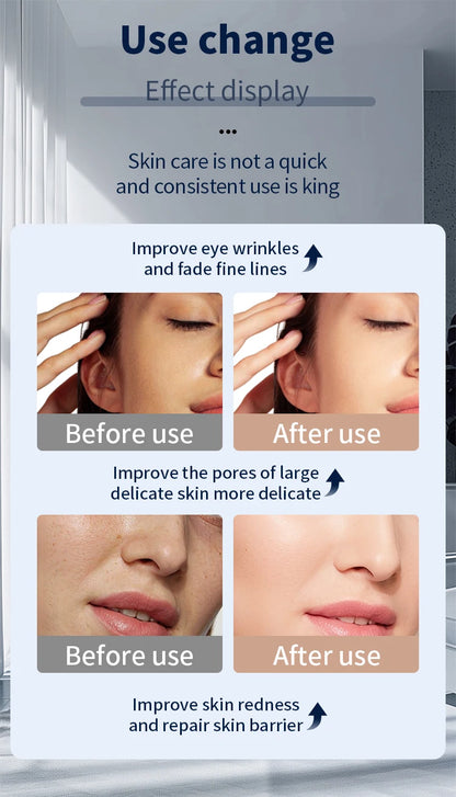 LED Maska na Tvár a Krk – 7 Farieb Bezdrôtová Prenosná