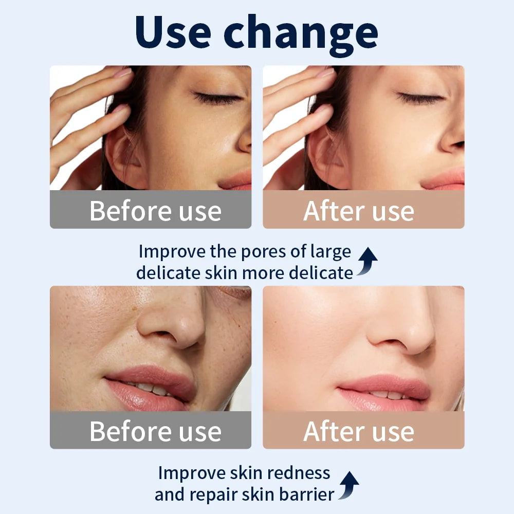 LED Maska na Tvár a Krk – 7 Farieb Bezdrôtová Prenosná