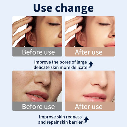 LED Maska na Tvár a Krk – 7 Farieb Bezdrôtová Prenosná