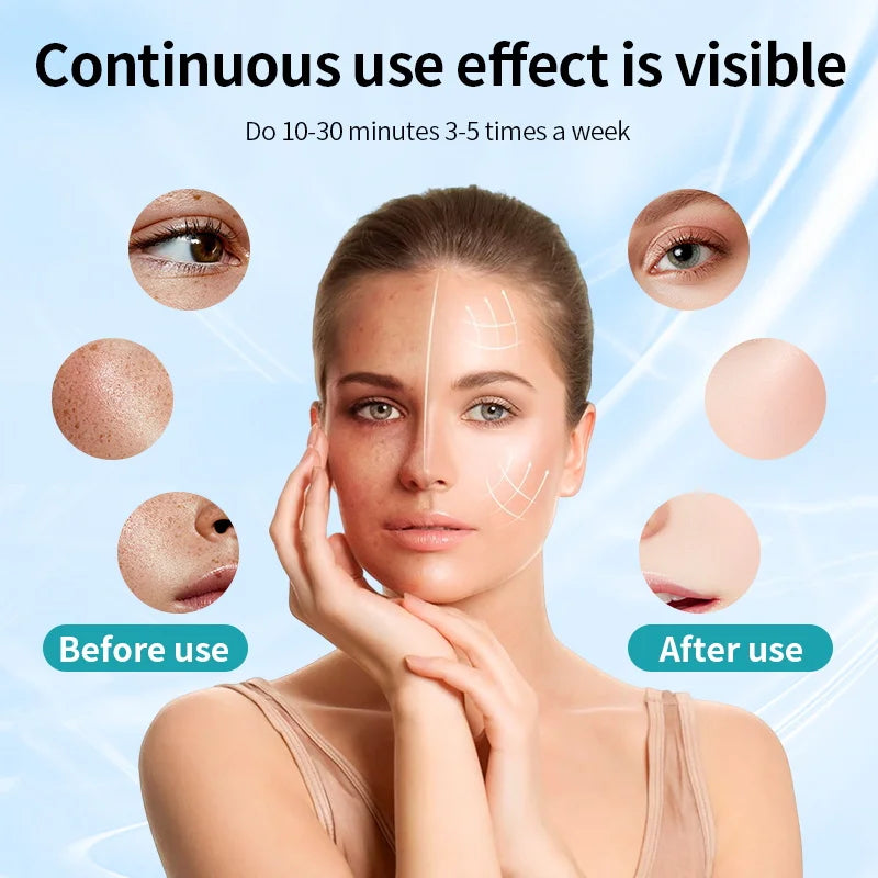 LED Maska na Tvár a Krk – 7 Farieb Bezdrôtová Prenosná